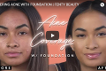 Úžasná transformácia ženy s akné: 4 kozmetické produkty zmenili jej tvár na nepoznanie