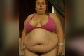 Neuveriteľná premena morbídne obéznej ženy: Na nových fotografiách by ste ju nespoznali!