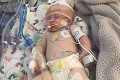 Rodičia zobrali bábätko na zápas: Teraz bojuje o život v nemocnici