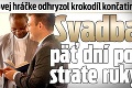 Bývalej tenisovej hráčke odhryzol krokodíl končatinu: Svadba päť dní po strate ruky