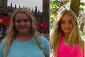 Tínedžerka Josephine vážila 120 kg: Zmenila jednu vec a schudla polovicu svojej váhy!