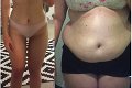 Tínedžerka Josephine vážila 120 kg: Zmenila jednu vec a schudla polovicu svojej váhy!