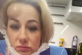 Exfarmárka dostala šmyk: Hrozivá autonehoda! Na tvári má škaredé zranenie