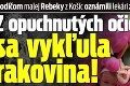 Rodičom malej Rebeky z Košíc oznámili lekári zdrvujúcu správu: Z opuchnutých očiek sa vykľula rakovina!