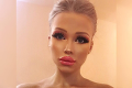 Česká Barbie má len 17 rokov a megaprsia veľkosti osem: Ukázala hrudník po plastike