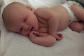 Fotky len pre silné povahy! Rodičia sa tešili na bábätko, potom prišiel šok: Chlapček sa narodil BEZ očí!