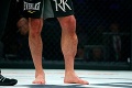 Stojí to za tie peniaze? Takto vyzerá VÍŤAZ po zápase v MMA, a to ste ešte nevideli jeho nohu... Otras!