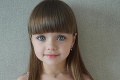 Anna je označovaná za najkrajšie dieťa na svete, má to však háčik: Temné pozadie jej dokonalých FOTIEK!
