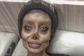 Žena (19) chcela vyzerať ako Angelina Jolie, výsledok je desivý: Po plastikách sa jej zľaknete aj za bieleho dňa!
