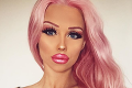Česká Barbie (18) zverejnila FOTO spred piatich rokov: Ako vyzerala, kým sa z nej stala silikónová umelina?