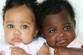 Bábätká sa stali hviezdami internetu: Povedali by ste, že sú to naozaj dvojičky?!