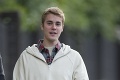 Justin Bieber neudržal nervy na uzde: Mladý fanúšik skončil s krvavou tvárou!