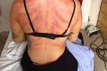 Kaderníčka doplatila na pracovné tempo: Desivá fotka jej tela obletela internet