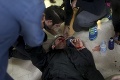 Hrôza v Katalánsku: Násilnosti si vyžiadali už 460 zranených!
