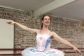 Najzvláštnejšia baletka na svete: Zistíte, čím bola Sophie v minulosti, obleje vás pot!