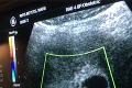Žena slávneho herca ukázala najsmutnejší ultrazvuk: Smrť vytúženého bábätka!