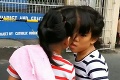 Siamské dvojičky žijú so zrastenými čelami už 10 rokov: Dievčatá čaká v živote ťažký boj