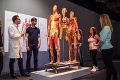 Kontroverzná výstava mŕtvych tiel: Body Exhibition rozdelila verejnosť!