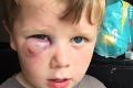 Na chlapčeka zaútočila skupina tínedžerov: Krutý spôsob ich napadnutia vás zaskočí!