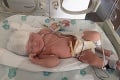 Dievčatko pri pôrode do smrti poznačili: Mama Emma zostala po slovách lekára v šoku