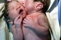 Žena priviedla na svet v siedmom mesiaci dvoch chlapcov: Po pôrode sa jej naskytol zdrvujúci pohľad!