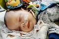 Maličký Majko už celé mesiace bojuje o život: Zlomový moment po 2 operáciách obrovského nádoru!