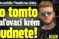 Muž ukázal, čo s ním urobilo 7 hodín na slnku: Brr, po tomto už na opaľovací krém nezabudnete!