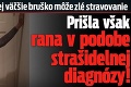 Myslela si, že za jej väčšie bruško môže zlé stravovanie: Prišla však rana v podobe strašidelnej diagnózy!