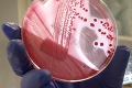 Vedci prišli s prevratnou novinkou: Baktéria E.coli vás zachráni pred potom