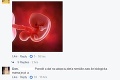 Slovenka zvažuje potrat, na Facebooku zisťuje podrobnosti: Drsné reakcie diskutujúcich!