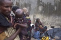 Nigériou lomcuje najhoršia epidémia za posledných 9 rokov: Vyžiadala si už 839 životov!