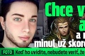 Chce vyzerať ako elf a na operácie minul už skoro 30 000 €: Keď ho uvidíte, nebudete veriť, že je to ten istý chlap!