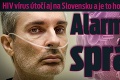 HIV vírus útočí aj na Slovensku a je to horšie, než si myslíte: Alarmujúca správa!