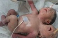 Horor po pôrode: Keď mamička uvidela, aké bábätko priviedla na svet, ostala zdrvená!