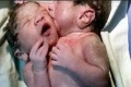 Horor po pôrode: Keď mamička uvidela, aké bábätko priviedla na svet, ostala zdrvená!