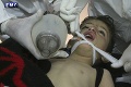Výsledky testov po útoku v Sýrii, kde zomrelo 87 ľudí: Najhoršie predpoklady sa potvrdili!