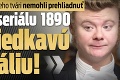 Diváci ten detail na jeho tvári nemohli prehliadnuť: Herec zo seriálu 1890 má zriedkavú anomáliu!