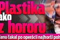 Plastika ako z hororu: Ženu čakal po operácii najhorší pohľad jej života!