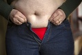 Žena 15 rokov priberala, hoci držala diéty: Keď sa konečne zmierila s obezitou, prišla zdrvujúca správa!