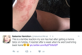 Známa speváčka dovolila synovi tetovanie hennou: Hrozivá kožná reakcia ju vystrašila na smrť!