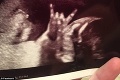 Rodičia išli na ultrazvuk, na tento pohľad neboli pripravení: Šialený detail na tele ich bábätka!