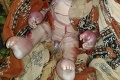 Mamičku zničil pohľad na svojho novorodenca, odmieta sa ho dotknúť: FOTO bábätka nevhodné pre citlivé povahy!