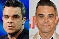 Fanúšikovia si mysleli, že ich klame zrak: Robbie Williams zázračne omladol!