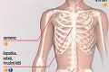 Sarkóm kostí je zriedkavým typom rakoviny: Aké sú príznaky?