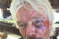 Miliardár Richard Branson sa zranil pri strašidelnom páde z bicykla: Myslel si, že zomrie!