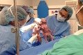 Fotka dvojičiek, ktoré sa po narodení držia za ruky, obletela svet: Ako vyzerajú dnes?