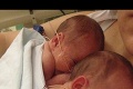 Fotka dvojičiek, ktoré sa po narodení držia za ruky, obletela svet: Ako vyzerajú dnes?