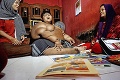 Arya je najobéznejší chlapec na svete: Školák váži až 192 kg, jeho krvné výsledky sú prekvapujúce