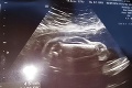 Keď si otec všimol bábätko na ultrazvuku, nemohol uveriť vlastným očiam: S kým je moja manželka tehotná?!