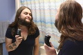 Žena trpí abnormálnym ochlpením, po 25 rokoch sa prestala holiť: Pozrite sa, akú má teraz bradu!
